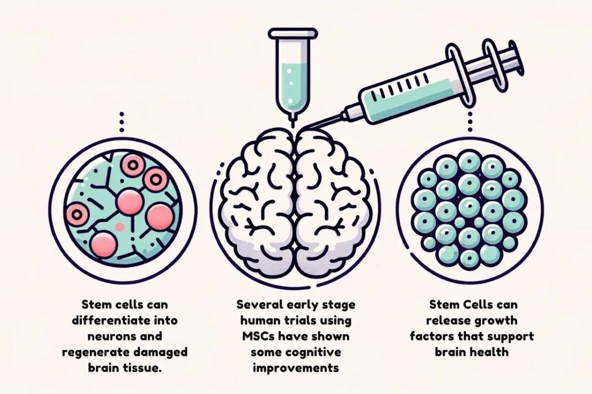 Alzheimer və Parkinsonda Beyin Bərpası: Kök Hüceyrə və Ekzosom Müalicəsi Nə Vəd Edir?